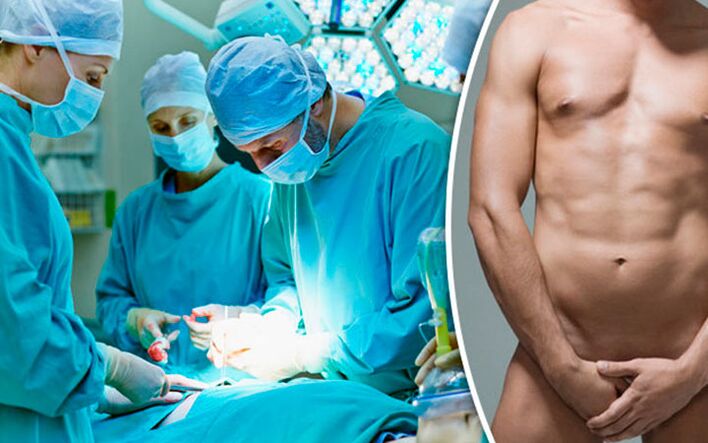 Surgical increase in penis