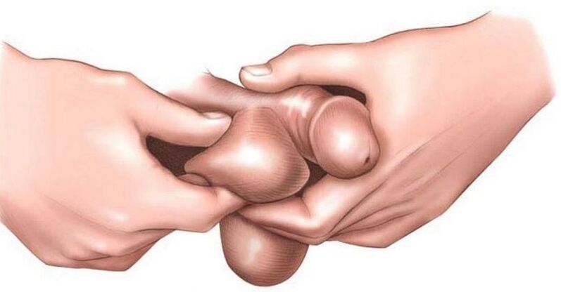 why do man balls itch